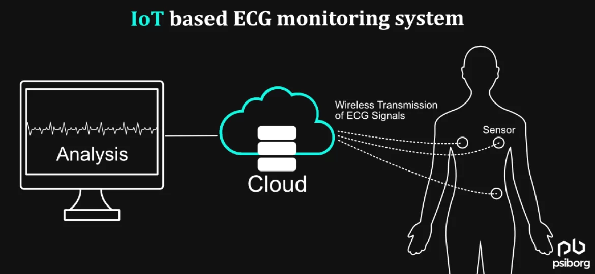 IoT-based ECG monitoring