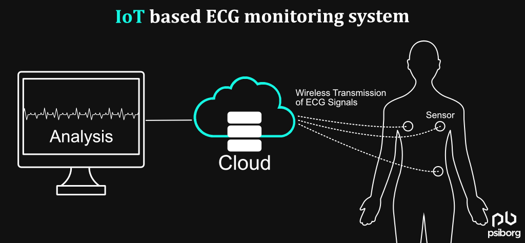 IoT-based ECG monitoring